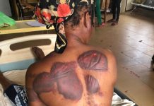 I Was Beaten and Nearly Burnt Alive In Tamale market by a Mob- Damongo Trader Narrates ordeal