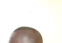 Let’s Prevent Bush Burning in Korupe Electoral Area of Bole- Unit Committee Member