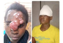 Abu Jinapor saves 36 Year old Damango lady suffering from tumor