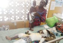 Abu Jinapor Transports Burnt Children To Tamale Teaching Hospital